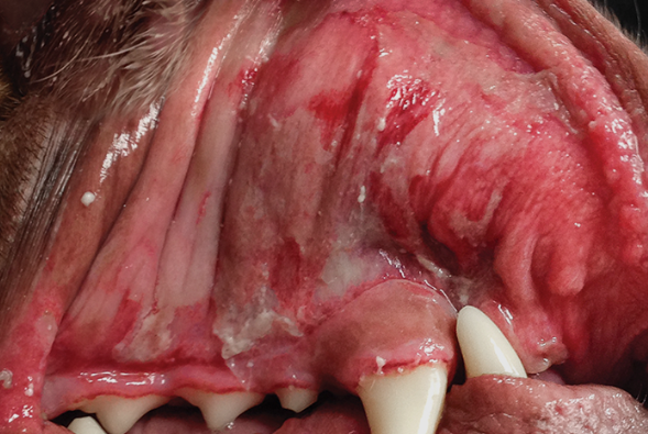 oral Ulcer